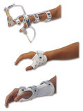 手関節装具（上から長対立装具、短対立装具、手背屈装具）